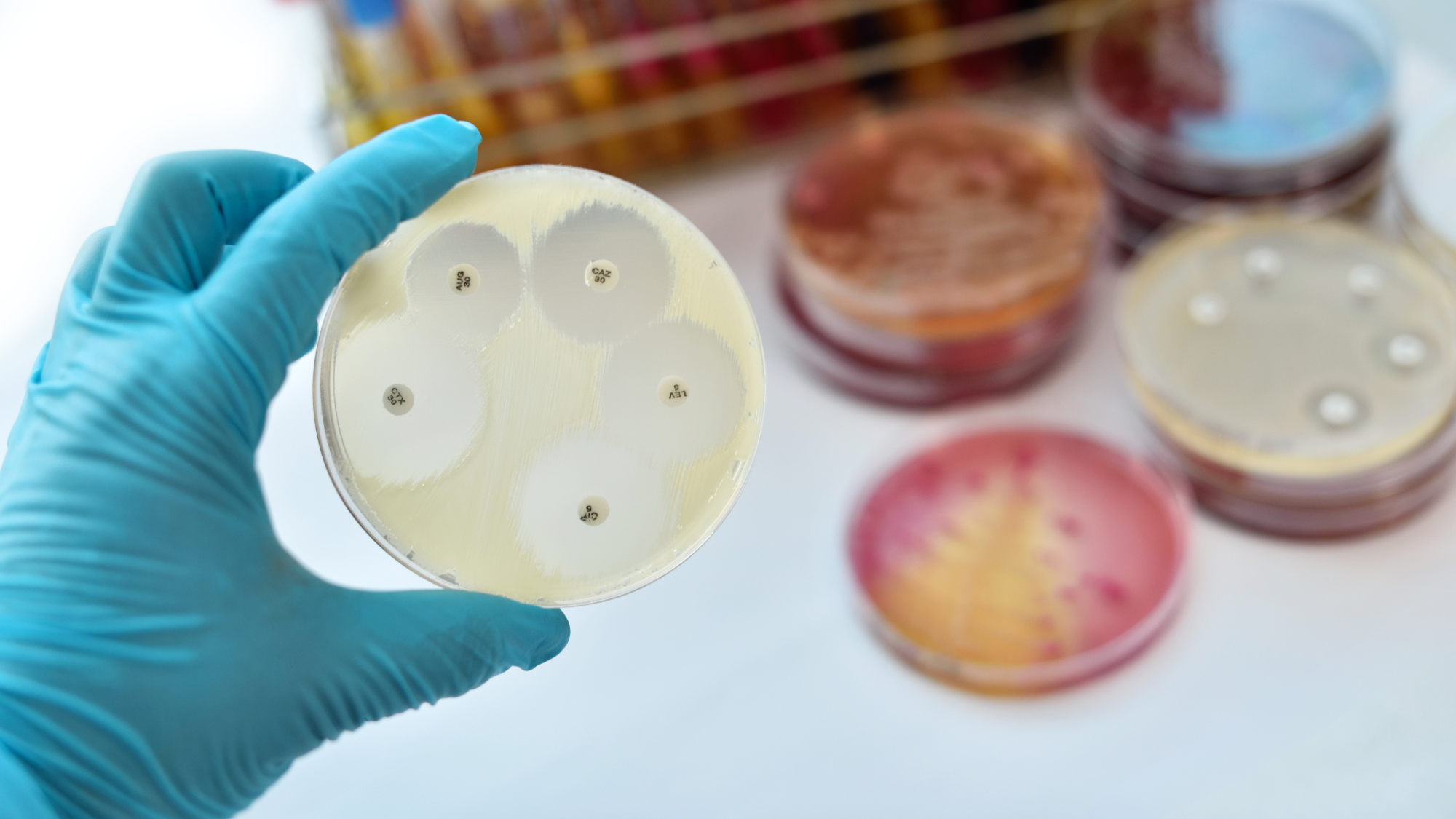 A gloved hand holding a petri dish containing bacterial culture.