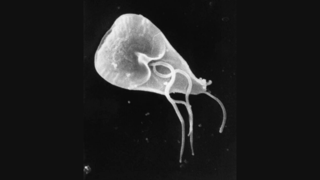 A magnified image of Giardia lamblia